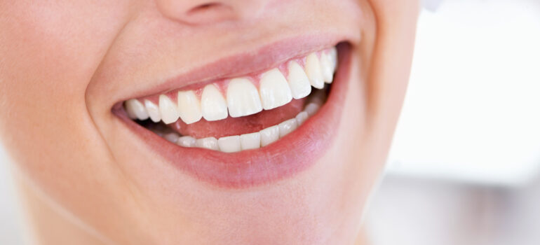 Cómo conseguir más pacientes de blanqueamiento dental con marketing digital