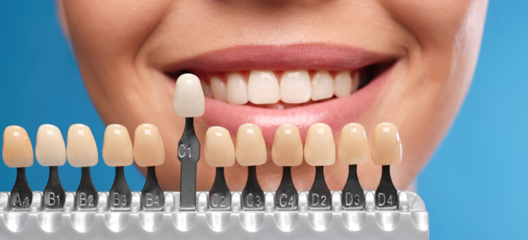 Marketing digital para clínicas de estética dental: cómo atraer pacientes que buscan la sonrisa perfecta